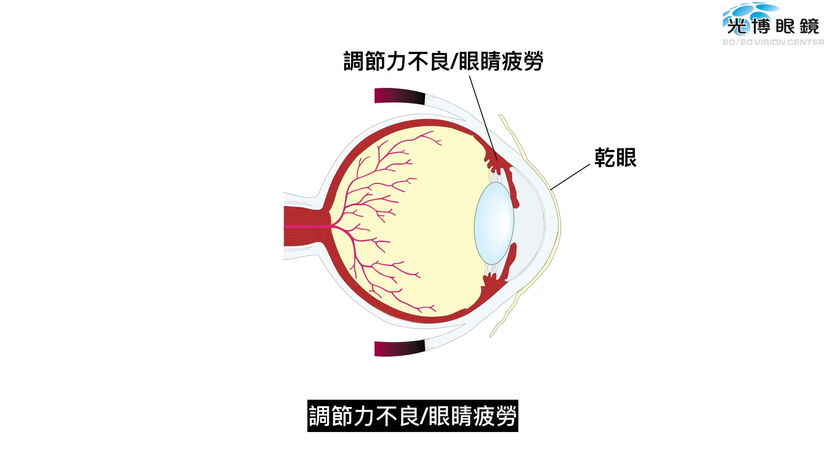 智慧型手機·桌上型電腦與眼睛疲勞-1